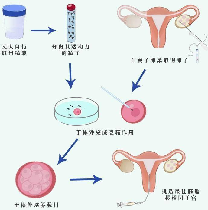 拉萨助孕